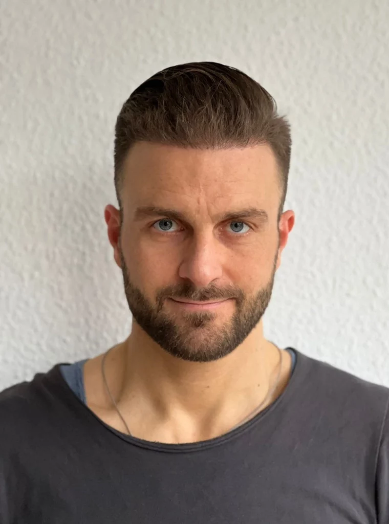 Till vor und nach der Haartransplantation in Köln