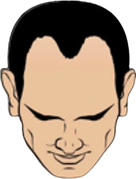 Haartransplantation Geheimratsecken